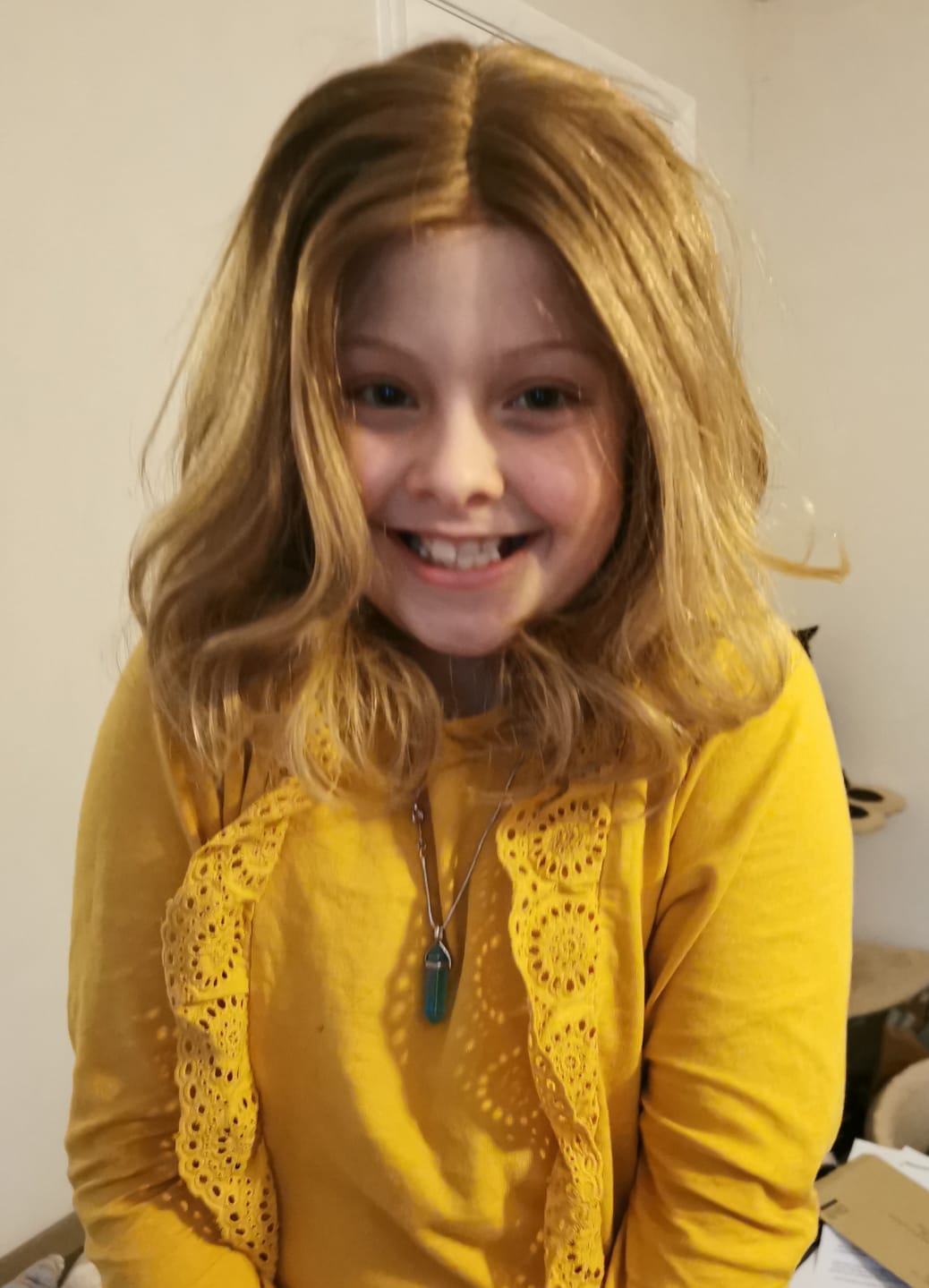 Wig restores Isla's confidence