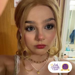 'Alopecia is much more than just losing your hair'