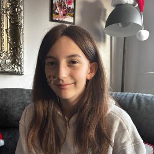 Wig recipient's kind and selfess gesture