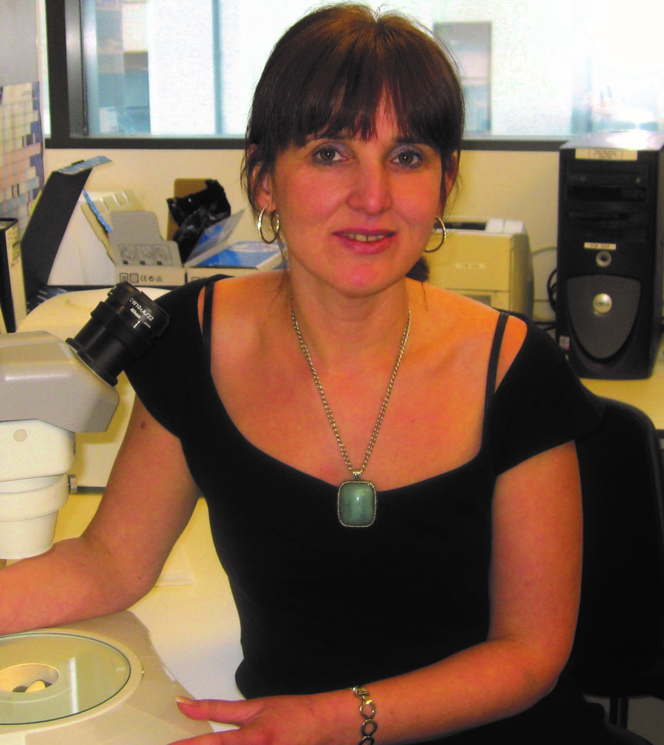 Professor Majlinda Lako has been looking for more effective treatments for retinoblastoma eye cancer.